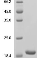 Escherichia coli O157:H7 Hydrogenase 3 maturation protease (hycI) Recombinant Protein, C-His-Myc - BioCrest Sci