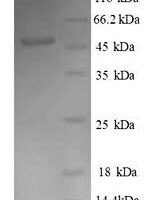 Human Dr1-associated corepressor (DRAP1), partial Recombinant Protein - BioCrest Sci