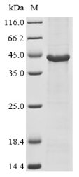 Mouse Acyl-CoA desaturase 1 (Scd1) Recombinant Protein, Mus musculus (Mouse), in vitro E.coli expression system, N-terminal 10xHis-tagged, 43.9 kDa, purity >≥ 85% as determined by SDS-PAGE.