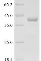 Human Cyclin-G-associated kinase (GAK), partial Recombinant Protein - BioCrest Sci