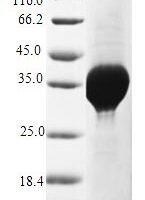 Saccharomyces cerevisiae Copper metallothionein 1-1 (CUP1-1) Recombinant Protein - BioCrest Sci