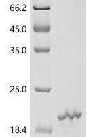 Human Proton-coupled zinc antiporter SLC30A8 (SLC30A8), partial Recombinant Protein, C-His - BioCrest Sci