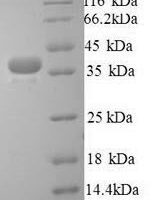 Human Talin-1 (TLN1), partial Recombinant Protein - BioCrest Sci