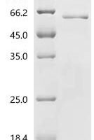 Hantaan virus Nucleoprotein (N) Recombinant Protein - BioCrest Sci