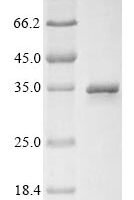 Rotavirus A Outer capsid protein VP4, partial Recombinant Protein, N-10His/C-Myc, aa 247–479 - BioCrest Sci