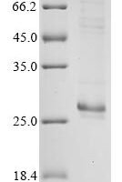 Bovine coronavirus Protein I (N) Recombinant Protein, C-His, aa 1–207, strain 98TXSF-110-LUN - BioCrest Sci