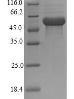 Mouse Thioredoxin-interacting protein (Txnip) Recombinant Protein, N-His-B2M - BioCrest Sci