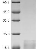 Rat Thyrotropin subunit beta (Tshb) Recombinant Protein, N-His/C-Myc - BioCrest Sci