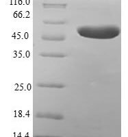 Human Metaxin-2 (MTX2) Recombinant Protein - BioCrest Sci