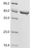 Staphylococcus epidermidis Ornithine carbamoyltransferase (argF) Recombinant Protein - BioCrest Sci