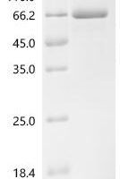 Phleum pratense Pollen allergen Phl p 1 (PHLPI) Recombinant Protein, C-hFc1 - BioCrest Sci