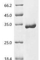 Candida albicans Agglutinin-like protein 3 (ALS3), partial Recombinant Protein, C-His, aa 18–329 - BioCrest Sci