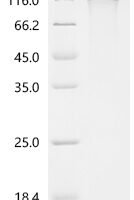 Human Collagen alpha-1(III) chain (COL3A1) Recombinant Protein - BioCrest Sci