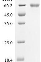 Human BTB/POZ domain-containing protein KCTD21 (KCTD21) Recombinant Protein, N-hFc1/C-10His - BioCrest Sci