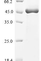Human Carboxypeptidase N catalytic chain (CPN1) Recombinant Protein, Tag-Free - BioCrest Sci