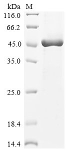 Human Carboxypeptidase N catalytic chain (CPN1) Recombinant Protein, Tag-Free, Homo sapiens (Human), E.coli, Tag-Free, 50.2 kDa, purity >≥ 85% as determined by SDS-PAGE.