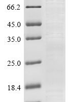 Human Tetraspanin-2 (TSPAN2), partial Recombinant Protein, Tag-Free - BioCrest Sci