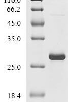 Bovine Beta-defensin 1 (DEFB1) Recombinant Protein - BioCrest Sci