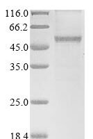Arabidopsis thaliana UDP-glycosyltransferase 88A1 (UGT88A1) Recombinant Protein, N-10His/C-Myc, aa 1–462, Baculovirus - BioCrest Sci