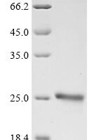 Human Neutrophil elastase (ELANE) Recombinant Protein, Tag-Free - BioCrest Sci