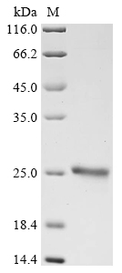 Human Neutrophil elastase (ELANE) Recombinant Protein, Tag-Free, Homo sapiens (Human), E.coli, Tag-Free, 25.7 kDa, purity >≥ 90% as determined by SDS-PAGE.