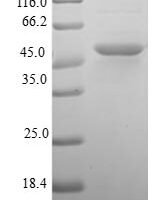 Human Dual specificity protein phosphatase 22 (DUSP22) Recombinant Protein - BioCrest Sci