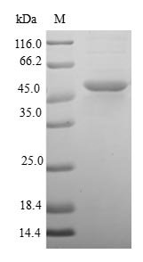 Human Dual specificity protein phosphatase 22 (DUSP22) Recombinant Protein, Homo sapiens (Human), E.coli, N-terminal GST-tagged, 47.8 kDa, purity >≥ 90% as determined by SDS-PAGE.