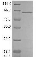 Human Aflatoxin B1 aldehyde reductase member 3 (AKR7A3) Recombinant Protein - BioCrest Sci