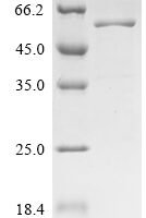 Human Scaffold protein ILK (ILK) Recombinant Protein, C-His - BioCrest Sci