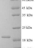 Bovine Interleukin-10 (IL10) Recombinant Protein - BioCrest Sci