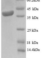 Human Mitochondrial import inner membrane translocase subunit TIM16 (PAM16) Recombinant Protein - BioCrest Sci