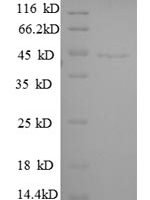Human Guanine nucleotide-binding protein G (i) subunit alpha-3 (GNAI3) Recombinant Protein, N-His - BioCrest Sci