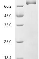 Human Serotransferrin(TF) Recombinant Protein - BioCrest Sci