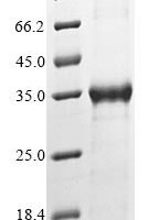 Human Myosin light chain kinase,smooth muscle (MYLK), partial Recombinant Protein - BioCrest Sci