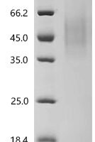 Human Pro-neuregulin-1, membrane-bound isoform (NRG1), partial Recombinant Protein, N-His, aa 2–246 - BioCrest Sci