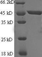 Human Immunoglobulin-like domain-containing receptor 2 (ILDR2), partial Recombinant Protein, N-GST - BioCrest Sci