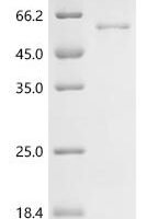 Mouse Adenylate cyclase type 10 (Adcy10), partial Recombinant Protein - BioCrest Sci