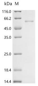 Mouse Adenylate cyclase type 10 (Adcy10), partial Recombinant Protein, Mus musculus (Mouse), E.coli, N-terminal 6xHis-tagged, 58.9 kDa, purity >≥ 90% as determined by SDS-PAGE.