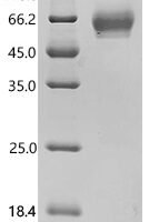 Mouse Programmed cell death protein 1 (Pdcd1), partial Recombinant Protein - BioCrest Sci