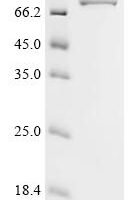 Human Tyrosine-protein kinase ZAP-70 (ZAP70) Recombinant Protein - BioCrest Sci
