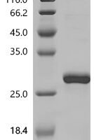 Human Caspase-8 (CASP8), partial Recombinant Protein, C-His - BioCrest Sci