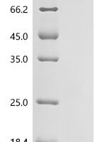 Human CD9 antigen (CD9), partial Recombinant Protein - BioCrest Sci