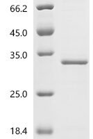 Arabidopsis thaliana TATA-box-binding protein 1 (TBP1) Recombinant Protein, N-His - BioCrest Sci