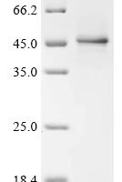 Human herpesvirus 6A Immediate-early protein 1 (U90/U89), partial Recombinant Protein, C-10His - BioCrest Sci
