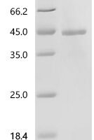 Human Interferon-induced, double-stranded RNA-activated protein kinase (EIF2AK2), partial Recombinant Protein, C-10His - BioCrest Sci