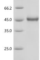 Human Teratocarcinoma-derived growth factor 1 (TDGF1) Recombinant Protein - BioCrest Sci
