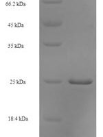Escherichia coli Peptidyl-tRNA hydrolase (pth) Recombinant Protein - BioCrest Sci