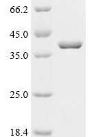 Human Dead end protein homolog 1 (DND1) Recombinant Protein - BioCrest Sci