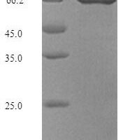 Staphylococcus aureus Transposase for transposon Tn552 Recombinant Protein - BioCrest Sci