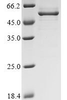 Infectious bronchitis virus Spike glycoprotein S1 subunit (S1), partial Recombinant Protein, N-His-B2M - BioCrest Sci